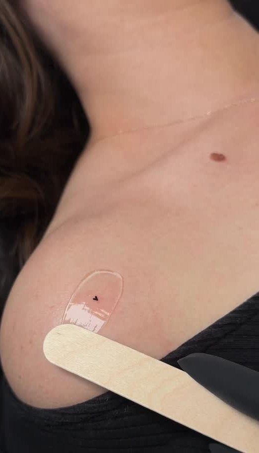 A tiny black heart tattoo on a person's collarbone under a clear film.